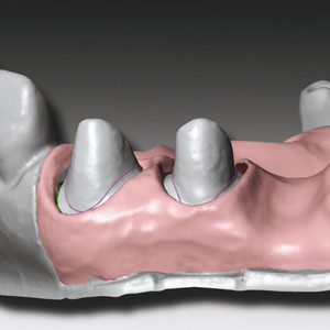 GINGIFAST CAD