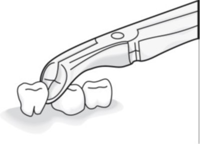 TOOTH FORCEPS - BLADE BEAKS