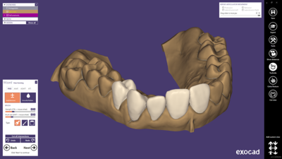 Provisional module