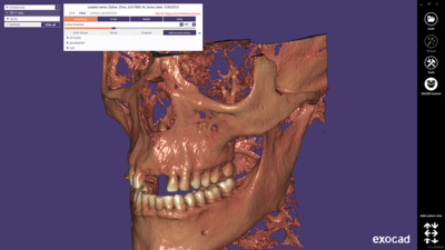 DICOM Viewer module