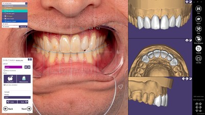 Smile Creator module