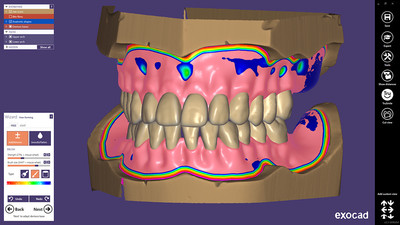 Full Denture module