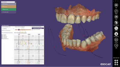 Jaw Motion Import module