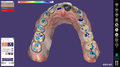 Auto Articulator module