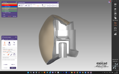 DIGITALNA KNJIŽNICA ACRYLOCK